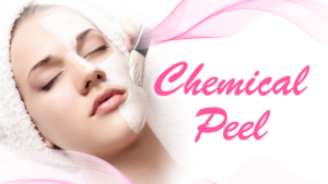 Dermatologists can perform chemical peels that use acids to exfoliate the skin and reduce the appearance of brown spots